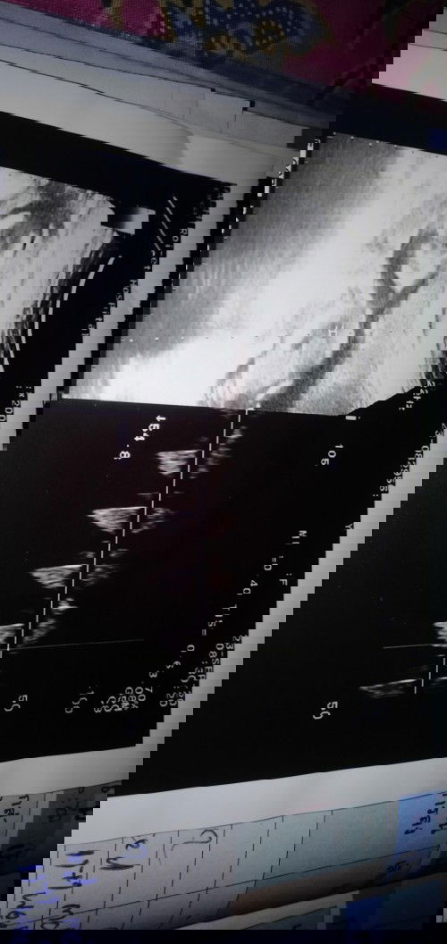 รู้สึกโล่งอก