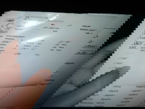 คืออะไรบ้างค่ะแม่​ แม่ๆที่รุ้ช่วยบอกหน่อยค่ะ