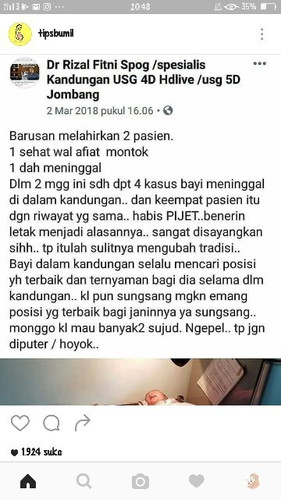 pijat benerin letak bayi