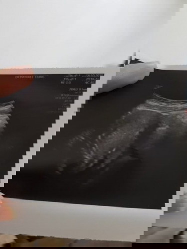 มีความกังวลหลังไปหาหมอค่ะ