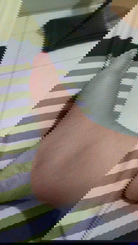 Kaki bengkak saat hamil