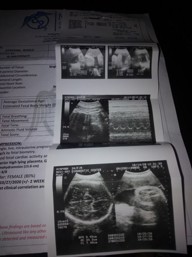 Ultrasound