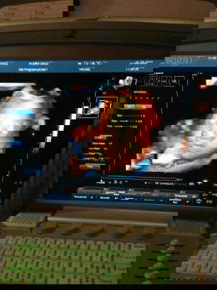 Mau nanya tentang usg