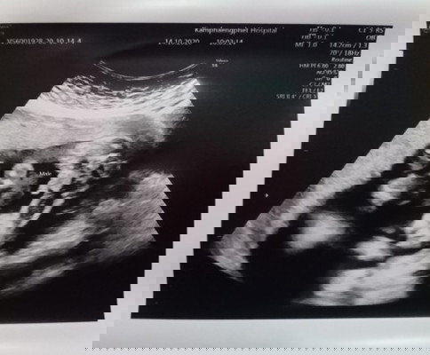 กำหนดคลอด ก.พ. รู้เพศกันยังเอ่ย?