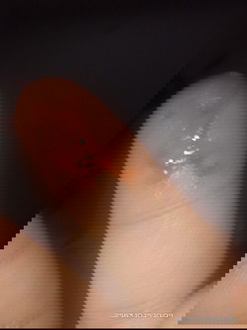 ท้องได้38week+3