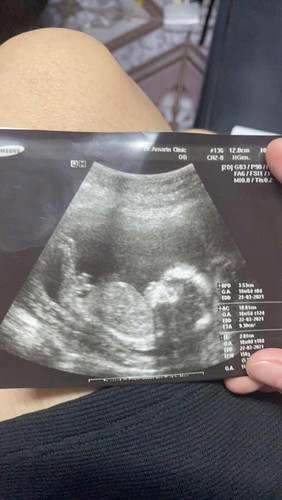 4เดือนแล้วค่ะ