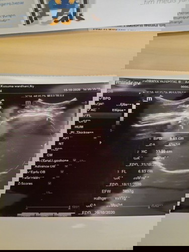 Induksi dan Pengapuran Plasenta