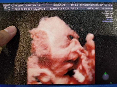 Being 1st time mom. 💜