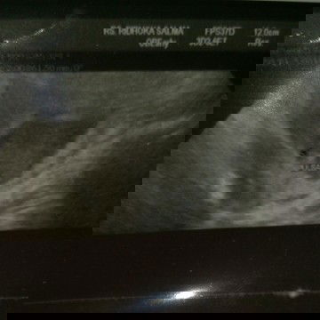 Janin tidak berkembang