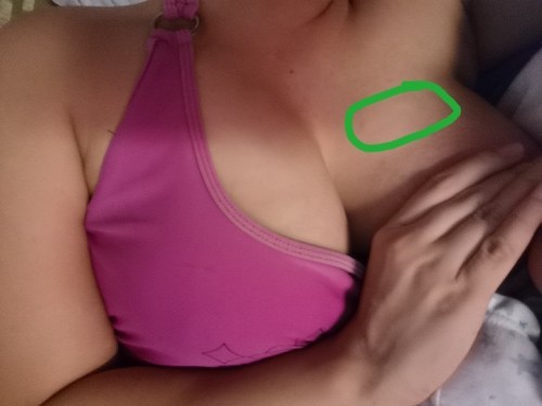 MASAKIT NA DEDE NORMAL BA??