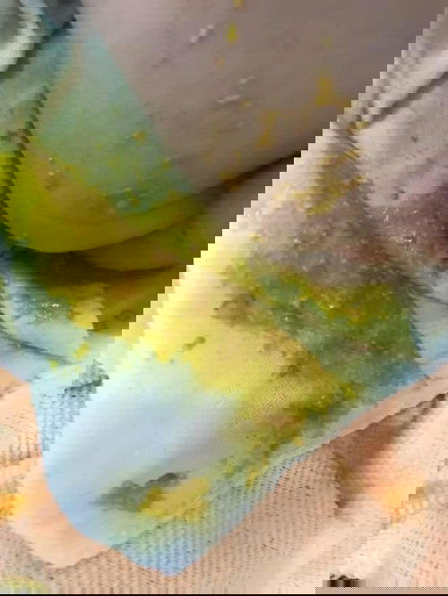 สีอึปกติไหมคะ