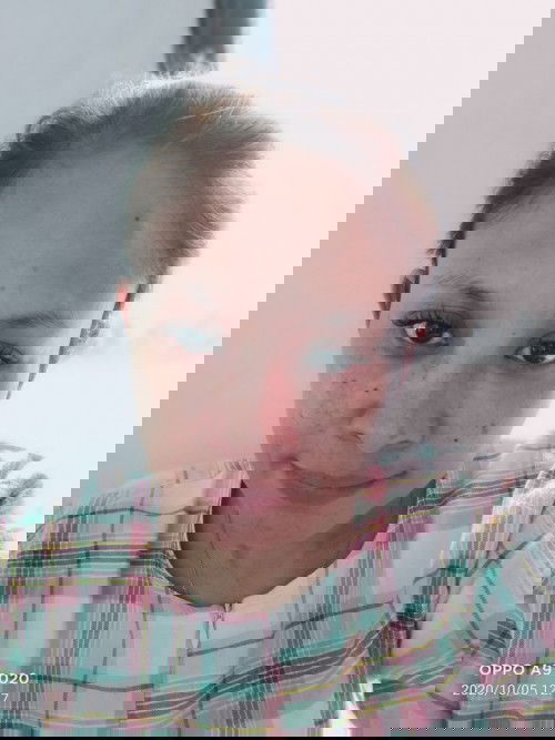 Knp jadi kluar flek2 diwajah