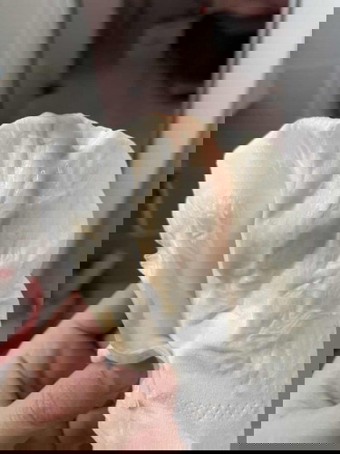 มูกเลือดก่อนคลอดใช่ไหมคะ