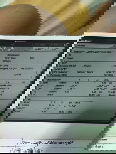 ดูเพศลูกตรงไหนคะ