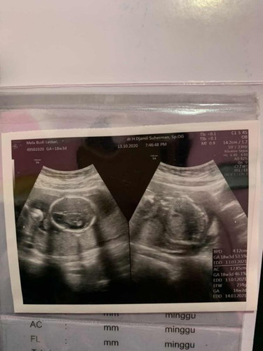 Tendangan bayi dalam perut