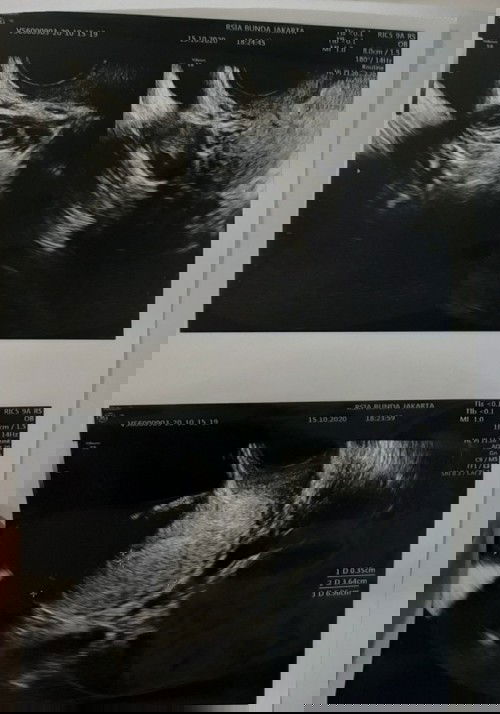 Cuma bisa nangis 😭