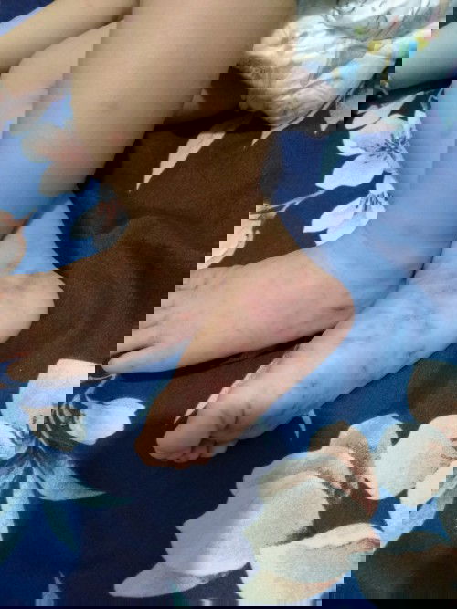 gatal/alergi/eksim (bingung)