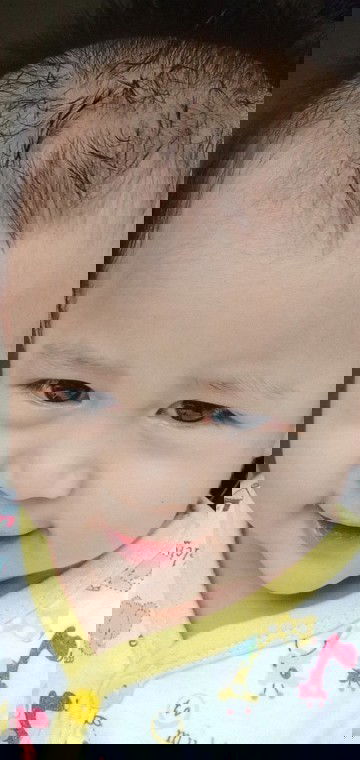 Bayi ku sudah 5hari demam