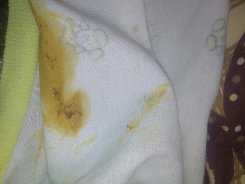 kenapa dan bagaimana solusinya? mon maap poto nya bukan jorok atau tdk sopan, tp buat memperjelas aja