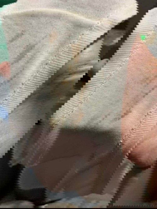 Implantation pa rin po ba to?