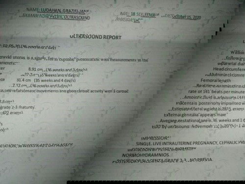 Ultrasound Result