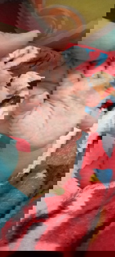 Maaf bunda" mau tanya donk ank saya merah" di tangan sma kaki itu kenapa ya bintik" gtu carangilangu