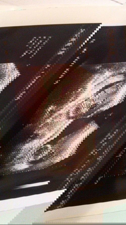 Bbj 17 week 753gram normalkah?