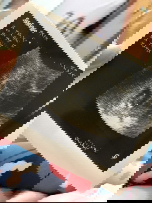 กังวลว่าลูกจะตัวเล็ก