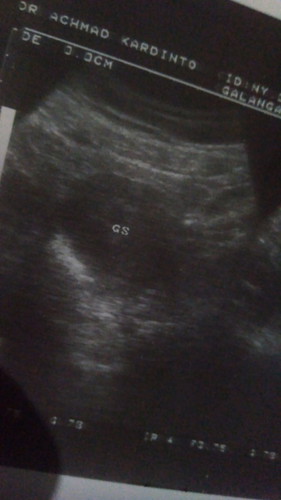 Mkanan apa ya yg bikin janin selalu tumbuh kuat untuk trimesti pertma ku aku ingin yg trbaik bun