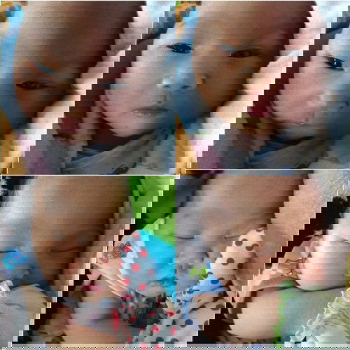 ประสบการณ์คลอดลูกตอนอายุ 19 ปี  เจ็บ x2 (ผ่าคลอดฉุกเฉินเเนวตั้ง)