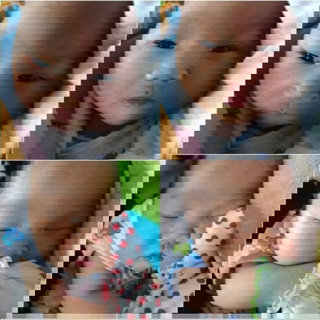 ประสบการณ์คลอดลูกตอนอายุ 19 ปี  เจ็บ x2 (ผ่าคลอดฉุกเฉินเเนวตั้ง)