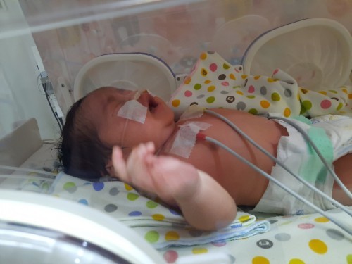 Cerita Kelahiran Bayiku dengan Tali Pusat Pendek