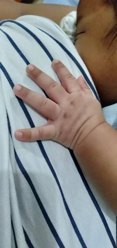 Tanong ko lang po kung sino same case ko dito na yung kamay ni baby sobrang puti