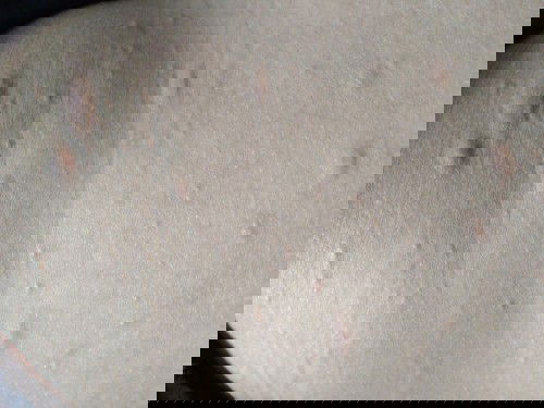 Bầu 3 tháng cuối bị ngứa, nổi mẩn đỏ.