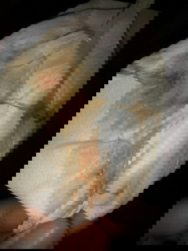 Maaf bund.. Mau tanya ini darah apa ya ? Implantasi atau bukan?