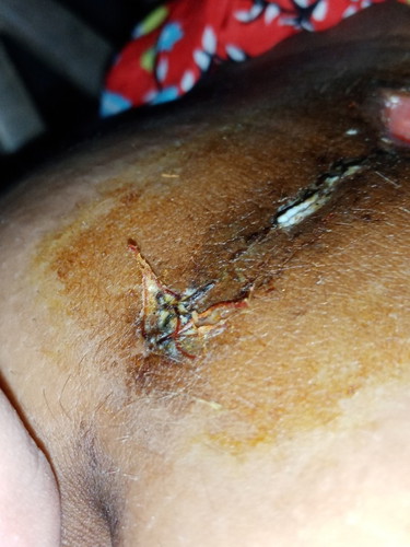 CS tahi problem