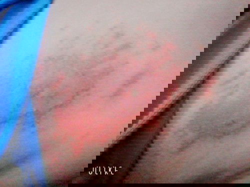 Hepppppp meeeee có mom nào biết bé bị gì đây không ạ ?? Giúp e với ,em  có đưa bé đi khám mà k khỏi