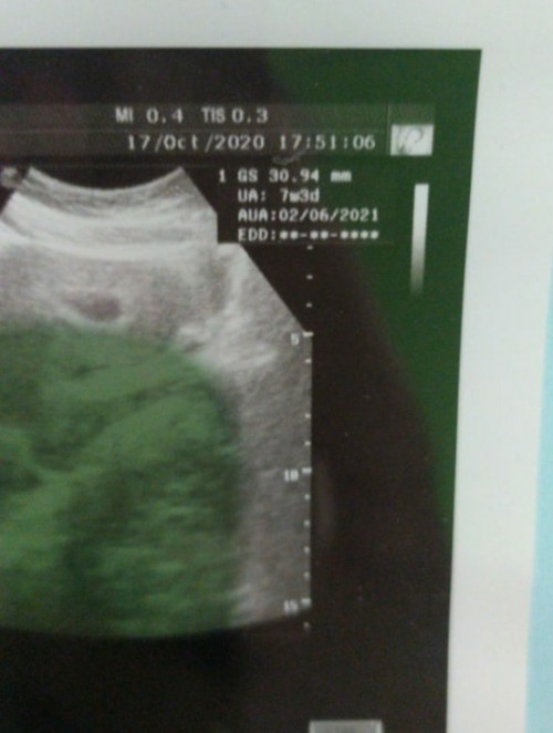 HPL beda antara puskesmas sama dokter