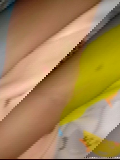 ลูกไม่สบาย ท้องร่วง เเล้วขึ้นจุดเเดงๆเเบบนี้หลายจุด เวลาเช็ดเสรจข้างหลังจะขึ้นจุดเเดงเยอะมาก