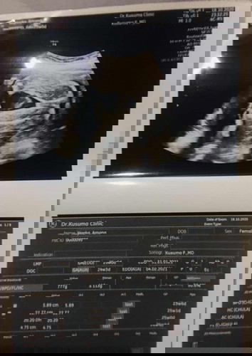 25 W ได้ลูกสาวถูกใจพ่อเค้าเรย
ทีมมกราคม
