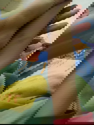 Melenting,keluar cairan...ini kenapa ya dok