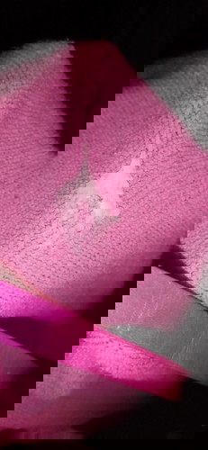 เป็ตตกขาวหรือว่ามูกค่ะออก2ครั้งท้องได้40วิคพอดีค่ะไม่มีอาการใดๆ