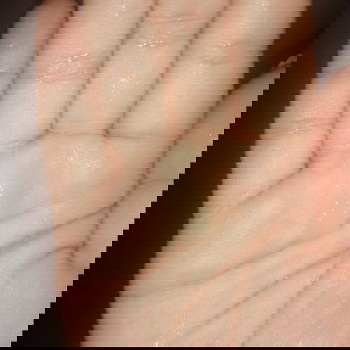 แบบนี้มูกใสหรือตกขาวคะ