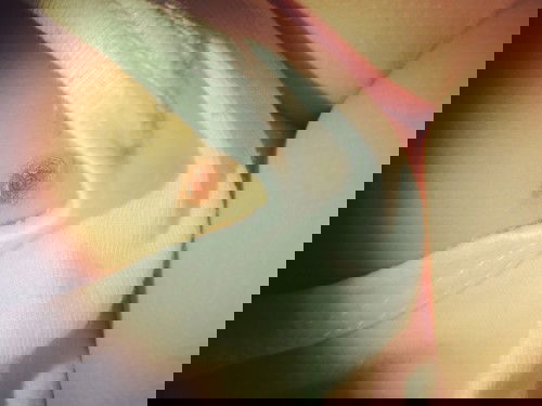 Nagsugat na excess skin