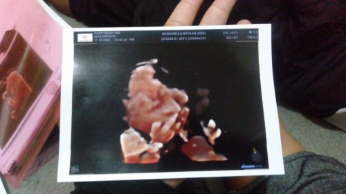 Jenis kelamin my baby