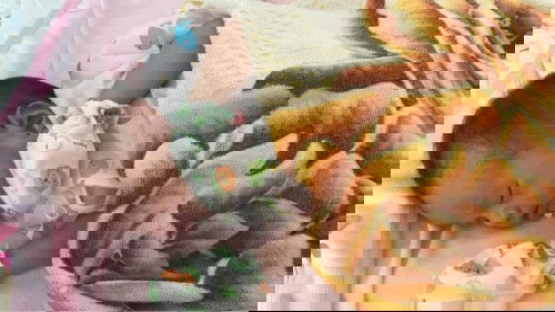 ลูกคลอดมาไม่นานแม่แม่ให้ลูกนอนท่าไหนบ้างค่ะที่จะให้หัวทุยสวย