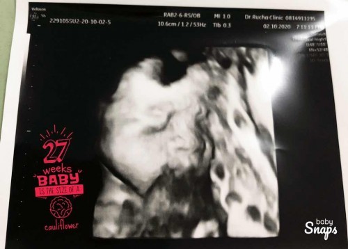 27 weeks นน น้องเท่าไหร่กันแล้วค่ะ