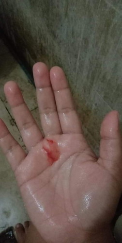 Normal po ba ito sa pagbubuntis?
