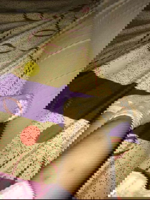 Bekas gigitan nyamuk