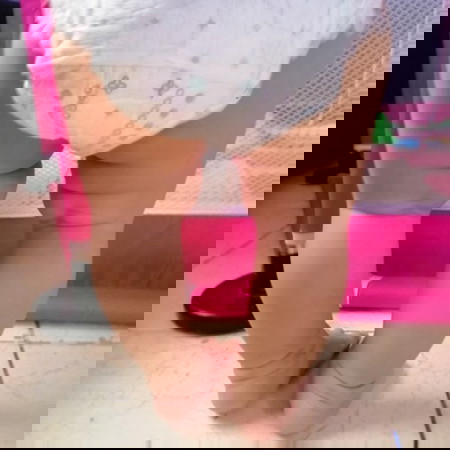 Slightly bowed legs